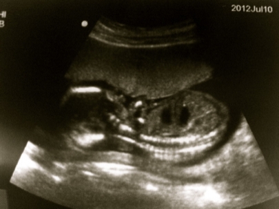 Teri Yaki grew and only doctor knows the gender - I LOVE SURPRISES!!! 